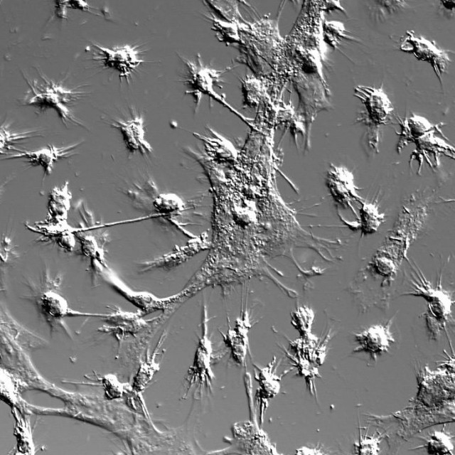 Murine bone marrow-derived macrophages on a dish (by Shann Yu)