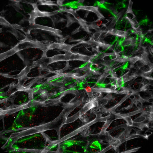 Swartz lab image (taken by Witold Kilarski) showing lymphatic vessel network in mouse ears