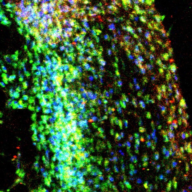Immunofluorescence image of inflamed mouse skin (by Shann Yu)