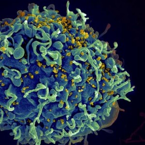 NIH stock image showing a pseudocolored micrograph of HIV infecting a T cell