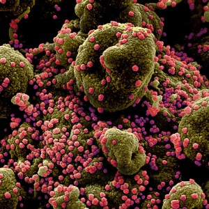 NIH stock image of SARS-CoV-2 infection